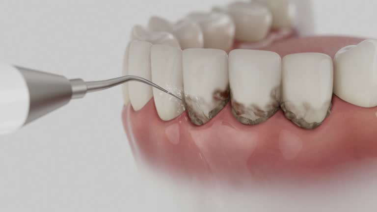 Trusted Invisalign Clear Aligners service in Parkside, PA - Dentist Open Now